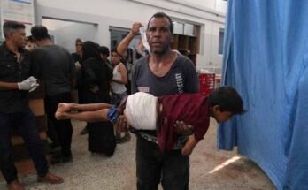 Un hombre usa un niño, herido en una huelga israelí, después de ser tratado en el Hospital Shifa, la ciudad de Gaza el lunes.